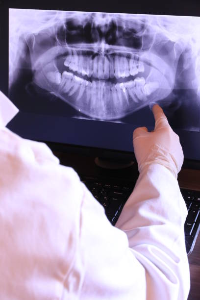 Best Emergency Treatment for Dental Infections or Abscesses in Tecumseh, NE