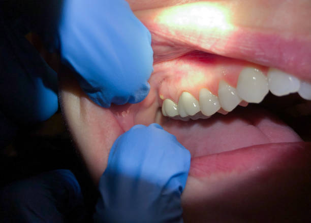Best Pediatric Emergency Dentist in Tecumseh, NE
