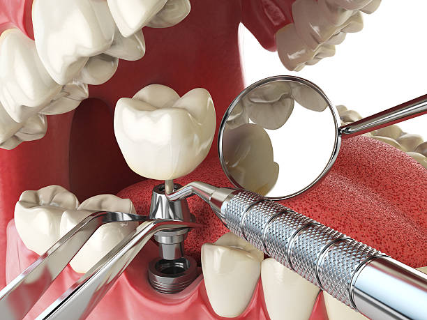 Best Cosmetic Emergency Dentistry in Tecumseh, NE